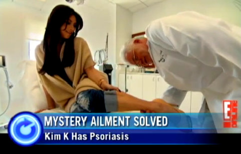 Kim Kardashian's psoriasis diagnosis Kim Kardashian sees a doctor about an